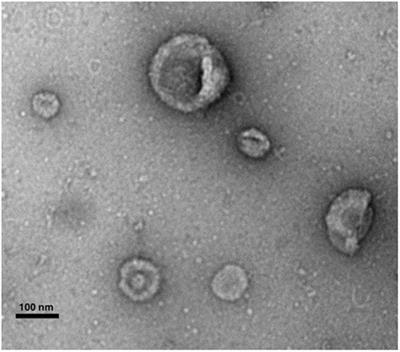 Recent Developments in Cellular Immunotherapy for HSCT-Associated Complications